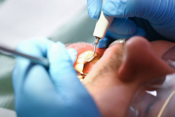 Best Emergency Root Canal Treatment in Lake Mathews, CA